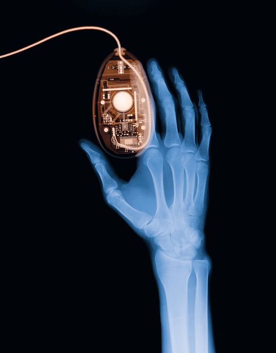 Social Business heißt auch, dass User und deren Klicks durchleuchtet werden. Social Business heißt auch, dass User und deren Klicks durchleuchtet werden.