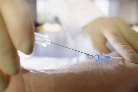 Der HTA-Bericht kommt zu dem Schluss, dass sich durch den Einsatz von Minocyclin/Rifampicin (MR)-beschichteten zentralvenösen Kathetern die Infektionsraten und damit auch Kosten senken lassen Der HTA-Bericht kommt zu dem Schluss, dass sich durch den Einsatz von Minocyclin/Rifampicin (MR)-beschichteten zentralvenösen Kathetern die Infektionsraten und damit auch Kosten senken lassen