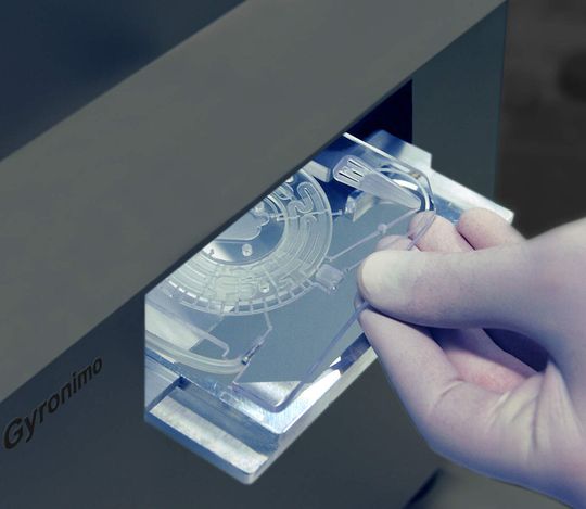 Das vollautomatisierte Real-Time-PCR-System Gyronimo ermöglicht mikrobiologische Echtzeit-Analysen direkt am Point-of-Care. Das vollautomatisierte Real-Time-PCR-System Gyronimo ermöglicht mikrobiologische Echtzeit-Analysen direkt am Point-of-Care.