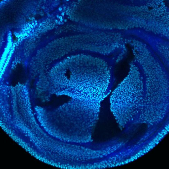 Flügel-Imaginalscheibe einer Taufliege: Die schwarzgefärbten Zellen können keine Histonmodifikation am Lysin vornehmen. Dennoch können sie sich teilen und Gene ablesen. Die dunkelblaue Färbung markiert die nicht-mutanten Zellen, Cyan markiert die Modifikation am Lysin. Flügel-Imaginalscheibe einer Taufliege: Die schwarzgefärbten Zellen können keine Histonmodifikation am Lysin vornehmen. Dennoch können sie sich teilen und Gene ablesen. Die dunkelblaue Färbung markiert die nicht-mutanten Zellen, Cyan markiert die Modifikation am Lysin.