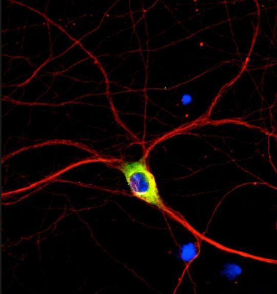Das HDAC6 Protein (grün) reguliert den Transport von Mitochondrien – den Kraftwerken der Zellen – entlang von Das