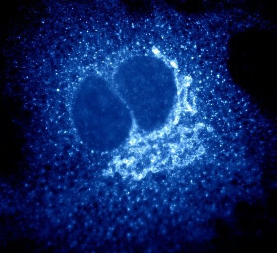 Abb. 1: Protein-befüllte COP I Transportvesikel wurden mittels einer Immunfluoreszenzfärbung in einer Fibroblastenzelle sichtbar gemacht. Abb. 1: Protein-befüllte COP I Transportvesikel wurden mittels einer Immunfluoreszenzfärbung in einer Fibroblastenzelle sichtbar gemacht.