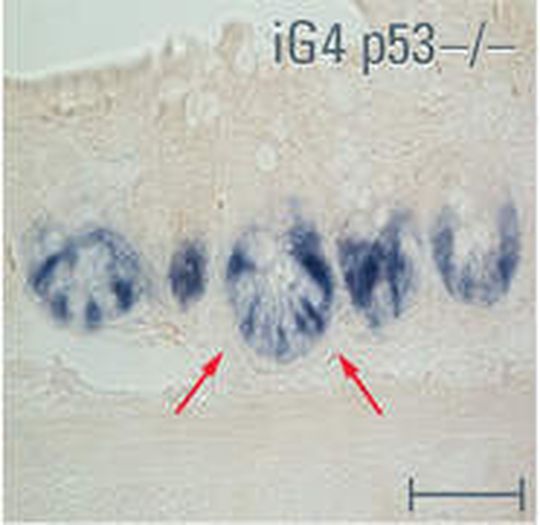 Immunhistochemische Färbung zur Identifizierung der intestinalen Stammzellen: Im alternden Gewebe mit intakten p53 werden die Stammzellen deletiert. Immunhistochemische Färbung zur Identifizierung der intestinalen Stammzellen: Im alternden Gewebe mit intakten p53 werden die Stammzellen deletiert.
