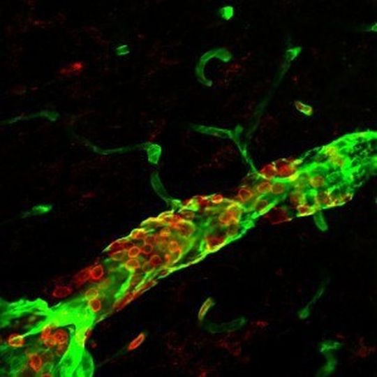Ein Blutgefäß im Gehirn: Entgegen der gängigen Lehrmeinung dringen die neutrophilen Granulozyten (rot) nicht in das Gehirngewebe ein. Ein Blutgefäß im Gehirn: Entgegen der gängigen Lehrmeinung dringen die neutrophilen Granulozyten (rot) nicht in das Gehirngewebe ein.