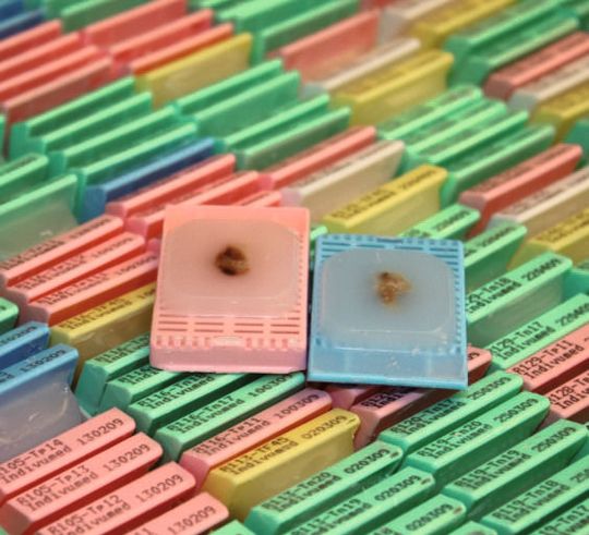 Abb.1: Die Biodatenbank von Indivumed umfasst biologische Proben von mehr als 15.000 Krebspatienten. Abb.1: Die Biodatenbank von Indivumed umfasst biologische Proben von mehr als 15.000 Krebspatienten.