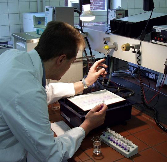 Eiweißelektrophorese am MRI Eiweißelektrophorese am MRI