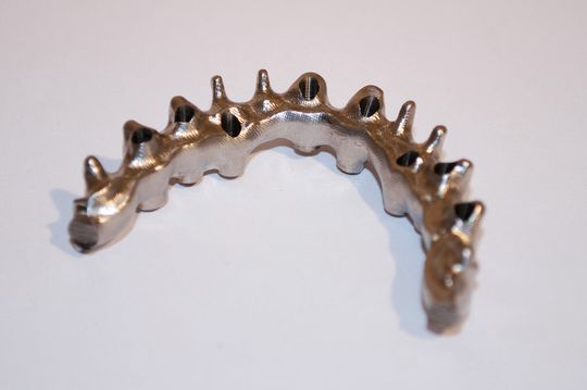 Mit WorkNC Dental wird die Herstellung von Modellen, Kronen, patientenspezifischen Pfeilern, Brücken oder Suprakonstruktionen auf Implantaten, Strukturen, Attachments, Scan-Locators usw. erleichtert. Mit WorkNC Dental wird die Herstellung von Modellen, Kronen, patientenspezifischen Pfeilern, Brücken oder Suprakonstruktionen auf Implantaten, Strukturen, Attachments, Scan-Locators usw. erleichtert.