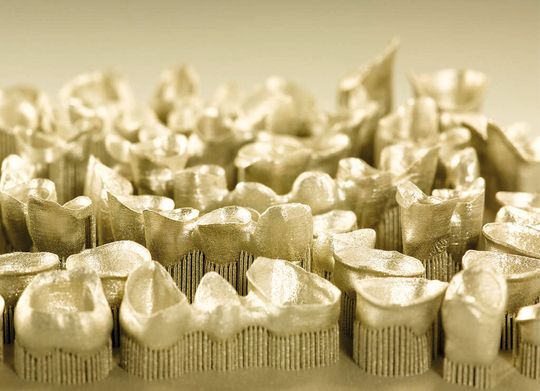 Dentalanwendung aus Rematitan CL von Dentaurum: Hervorstechend ist insbesondere die hohe Materialdichte, die für die hohen mechanischen Beanspruchungen bei Dentalanwendungen Vorteile gegenüber konventionellen Giessteilen bietet. Dentalanwendung aus Rematitan CL von Dentaurum: Hervorstechend ist insbesondere die hohe Materialdichte, die für die hohen mechanischen Beanspruchungen bei Dentalanwendungen Vorteile gegenüber konventionellen Giessteilen bietet.