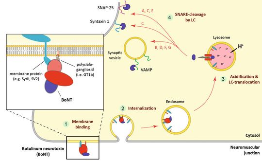 Abb.1: Wirkmechanismus von Botulinum Neurotoxin am Motoneuron (verändert nach Lalli et al. 2003 [8]).