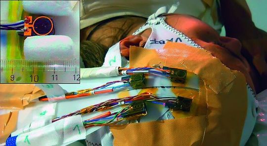 Vier im Bereich der motorischen und sensorischen Gehirnareale auf den Kopf eines Probanden geklebte CSAM-Magnetfeldsensoren. Die würfelförmigen Sensoren sind ähnlich einfach zu handhaben wie Elektroden. Kleines Bild: Dimension des Sensors und der zur lokalen Modulation des Feldes auf den Sensor aufgebrachten Spule (in der Aufsicht auf den Würfel). Vier im Bereich der motorischen und sensorischen Gehirnareale auf den Kopf eines Probanden geklebte CSAM-Magnetfeldsensoren. Die würfelförmigen Sensoren sind ähnlich einfach zu handhaben wie Elektroden. Kleines Bild: Dimension des Sensors und der zur lokalen Modulation des Feldes auf den Sensor aufgebrachten Spule (in der Aufsicht auf den Würfel).