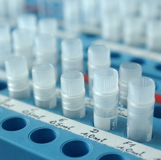 Am Helmholtz Zentrum München (HMGU) analysierten Forscher Daten zur psychischen Belastung am Arbeitsplatz sowie Konzentrationen entzündlicher Biomarker im Blut. Am Helmholtz Zentrum München (HMGU) analysierten Forscher Daten zur psychischen Belastung am Arbeitsplatz sowie Konzentrationen entzündlicher Biomarker im Blut.