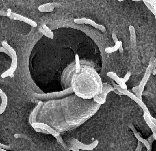 Streptococcus pyogenes, hier beim Eindringen in eine Zelle, ist eines des Bakterien, dessen CRISPR-Cas-System die Braunschweiger Wissenschaftler untersucht haben. Streptococcus pyogenes, hier beim Eindringen in eine Zelle, ist eines des Bakterien, dessen CRISPR-Cas-System die Braunschweiger Wissenschaftler untersucht haben.