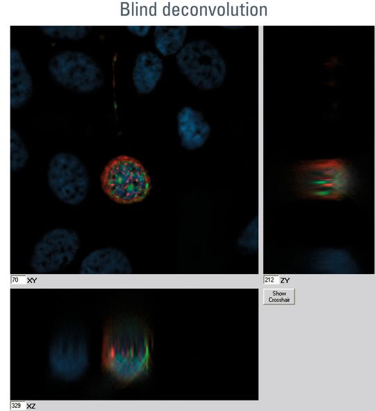 Abb. 1: Blind Deconvolution: Menschliche Drüsenkrebszellen wurden in einem Z-Stapel abgebildet. Nach der Blind Deconvolution nimmt die Unschärfe ab. Außerdem kann der Kontrast gesteigert werden und die Intensität erhöht sich. Abb. 1: Blind Deconvolution: Menschliche Drüsenkrebszellen wurden in einem Z-Stapel abgebildet. Nach der Blind Deconvolution nimmt die Unschärfe ab. Außerdem kann der Kontrast gesteigert werden und die Intensität erhöht sich.