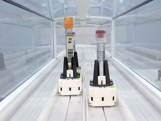 Das Probenfördersystem transportiert Proben mittels Cars einzeln auf Führungsrillen zu den jeweiligen Zielen und vermindert das Ausfallrisiko. Das Probenfördersystem transportiert Proben mittels Cars einzeln auf Führungsrillen zu den jeweiligen Zielen und vermindert das Ausfallrisiko.