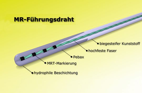 Bild 2 | Ein im MRT einsetzbarer Führungsdraht: Er könnte zukünftig verhindern, dass Arzt und/oder Patienten den im Vergleich zu herkömmlichen bildgebenden Röntgentechnik ionisierenden Strahlen ausgesetzt sind. Bild 2 | Ein im MRT einsetzbarer Führungsdraht: Er könnte zukünftig verhindern, dass Arzt und/oder Patienten den im Vergleich zu herkömmlichen bildgebenden Röntgentechnik ionisierenden Strahlen ausgesetzt sind.