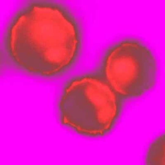 Mastzellen, die eine fluoreszierende Probe enthalten, die spezifisch das Membranlipid PtdIns(3,4,5)P3 bindet. Dieses Lipid gibt Auskunft über den Aktivierungszustand der Mastzellen. Mastzellen, die eine fluoreszierende Probe enthalten, die spezifisch das Membranlipid PtdIns(3,4,5)P3 bindet. Dieses Lipid gibt Auskunft über den Aktivierungszustand der Mastzellen.