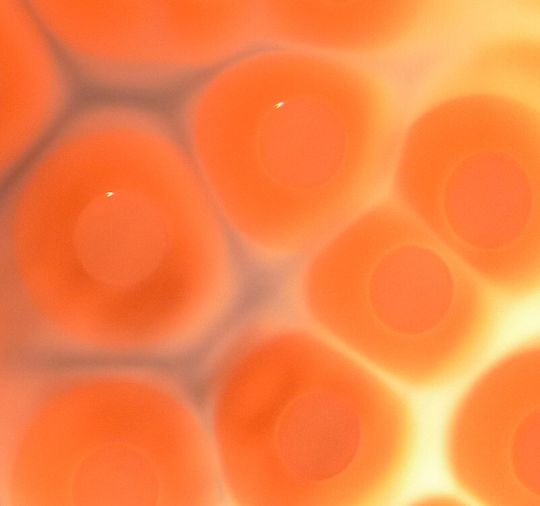 Staphylococcus-aureus-Bakterien auf Nährboden Staphylococcus-aureus-Bakterien auf Nährboden