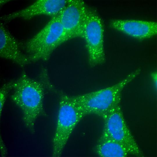 Stress-induzierte Akkumulation von TOP3b (grün) in cytoplasmatischen, mRNA-haltigen Granula. Stress-induzierte Akkumulation von TOP3b (grün) in cytoplasmatischen, mRNA-haltigen Granula.