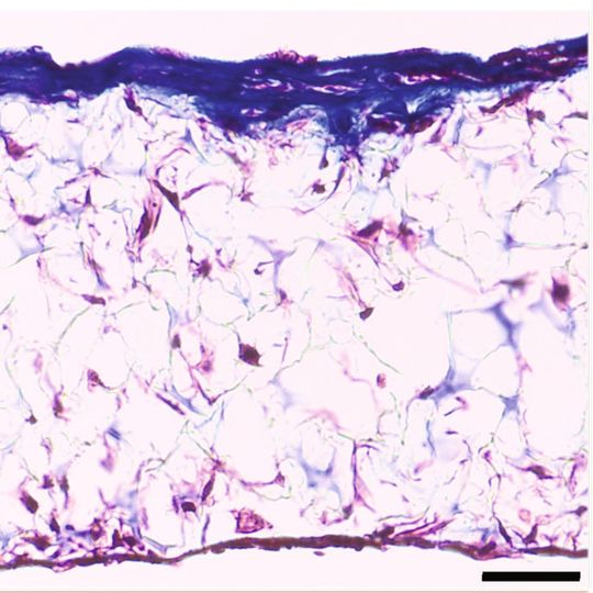 Abb. 1: Einlagerung von Collagen durch MSCs von Ratten, die sich in einer 3D-Zellkultur unter Verwendung von Alvetex-Scaffold zu Knochenzellen ausdifferenziert haben. Massons Trichrom-Färbung einer extrazellulären Collagenmatrix. Beachten Sie die Einlagerung bedeutender Mengen von Collagen in den oberen Schichten des Gerüstes. Maßstabsleiste: 40 μm Abb. 1: Einlagerung von Collagen durch MSCs von Ratten, die sich in einer 3D-Zellkultur unter Verwendung von Alvetex-Scaffold zu Knochenzellen ausdifferenziert haben. Massons Trichrom-Färbung einer extrazellulären Collagenmatrix. Beachten Sie die Einlagerung bedeutender Mengen von Collagen in den oberen Schichten des Gerüstes. Maßstabsleiste: 40 μm