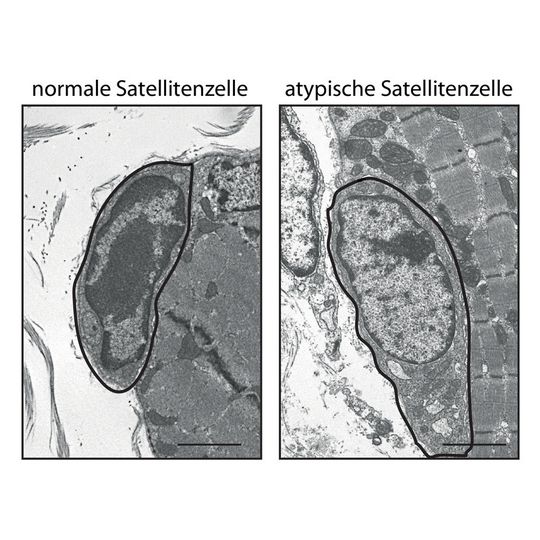 Aus der Form: Während das so genannte Heterochromatin im Zellkern einer normalen Satellitenzelle (markierte Zelle links) im Elektronenmikroskop eine charakteristische dunkle Färbung aufweist, ist der DNA-Faden bei einer Satellitenzelle ohne Pax7 (rechts) wesentlich weniger stark kondensiert. Dadurch erscheint der Zellkern heller. Aus der Form: Während das so genannte Heterochromatin im Zellkern einer normalen Satellitenzelle (markierte Zelle links) im Elektronenmikroskop eine charakteristische dunkle Färbung aufweist, ist der DNA-Faden bei einer Satellitenzelle ohne Pax7 (rechts) wesentlich weniger stark kondensiert. Dadurch erscheint der Zellkern heller.