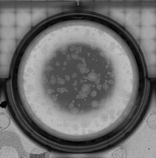 Humane iPS-Stammzellkolonien: Gezeigt wird eine mikroskopische Aufnahme eines einzelnen Wells einer 6-well-Mikrotiterplatte in 4-facher Vergrößerung, aufgenommen mit einer Geschwindigkeit von 34 mm/s. Das Übersichtsbild ist dabei aus dem Stitching von 120 Einzelbildern entstanden. Humane iPS-Stammzellkolonien: Gezeigt wird eine mikroskopische Aufnahme eines einzelnen Wells einer 6-well-Mikrotiterplatte in 4-facher Vergrößerung, aufgenommen mit einer Geschwindigkeit von 34 mm/s. Das Übersichtsbild ist dabei aus dem Stitching von 120 Einzelbildern entstanden.