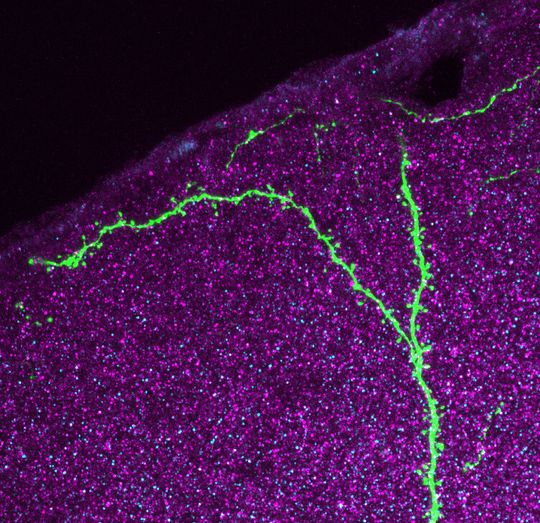 Schnittpräparat der Hörrinde einer genetisch veränderten Maus, in der ein einzelnes Neuron durch ein grün fluoreszierendes Protein markiert ist. Erregende Synapsen sind als sogenannte dendritische Dornen entlang der Fortsätze erkennbar. Gegenfärbung für die synaptischen Markerproteine ErbB4 (cyan) und Synapsin1 (magenta). Schnittpräparat der Hörrinde einer genetisch veränderten Maus, in der ein einzelnes Neuron durch ein grün fluoreszierendes Protein markiert ist. Erregende Synapsen sind als sogenannte dendritische Dornen entlang der Fortsätze erkennbar. Gegenfärbung für die synaptischen Markerproteine ErbB4 (cyan) und Synapsin1 (magenta).