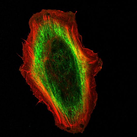 Immunfluoreszenzmikroskopie-Aufnahmen einer unveränderten Keratinozyte: Bei dieser Form der Lichtmikroskopie können zu untersuchende Strukturen mit hohem Kontrast dargestellt werden. Der dunkle Bereich in der Mitte ist der Zellkern, der von einem hellgrünen Ring von Keratinen umgeben wird. Bei den genveränderten Zellen würde der hellgrüne Bereich fehlen. Der äußere, rote Bereich besteht aus einem Netz des Strukturproteins Aktin. Immunfluoreszenzmikroskopie-Aufnahmen einer unveränderten Keratinozyte: Bei dieser Form der Lichtmikroskopie können zu untersuchende Strukturen mit hohem Kontrast dargestellt werden. Der dunkle Bereich in der Mitte ist der Zellkern, der von einem hellgrünen Ring von Keratinen umgeben wird. Bei den genveränderten Zellen würde der hellgrüne Bereich fehlen. Der äußere, rote Bereich besteht aus einem Netz des Strukturproteins Aktin.