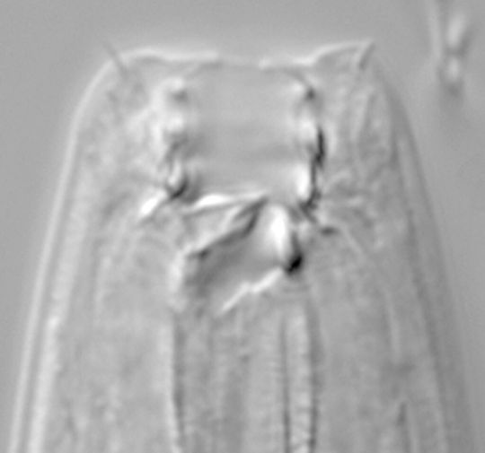 Pristionchus pacificus mit breiter Mundform. Diese Variante entwickelt sich, wenn die Würmer nicht genügend Nahrung finden oder zu dicht gedrängt leben. Pristionchus pacificus mit breiter Mundform. Diese Variante entwickelt sich, wenn die Würmer nicht genügend Nahrung finden oder zu dicht gedrängt leben.