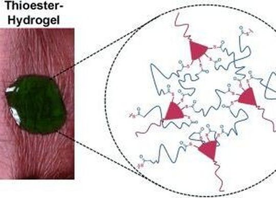 Amerikanische Wissenschaftler haben einen neuartigen Gel-Wundverschluss entwickelt, der sich chemisch wieder auflösen und so schonend entfernen lässt. Amerikanische Wissenschaftler haben einen neuartigen Gel-Wundverschluss entwickelt, der sich chemisch wieder auflösen und so schonend entfernen lässt.