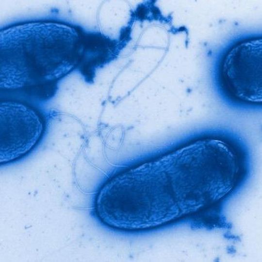 Pseudomonas aeruginosa – ein weitverbreiteter Krankenhauskeim Pseudomonas aeruginosa – ein weitverbreiteter Krankenhauskeim
