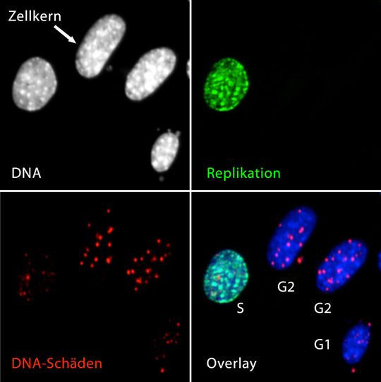 Die fluoreszenzmikroskopischen Bilder von Zellen, in denen das Gen NBS1 inaktiviert wurde, zeigen die DNA im Zellkern, sowie deren Replikation und DNA-Schäden (hiMAC-Analyse). Die fluoreszenzmikroskopischen Bilder von Zellen, in denen das Gen NBS1 inaktiviert wurde, zeigen die DNA im Zellkern, sowie deren Replikation und DNA-Schäden (hiMAC-Analyse).