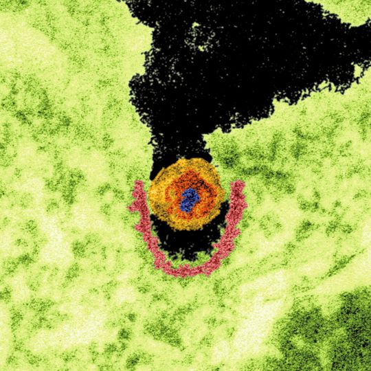 TEM-Aufnahme eines porz. endog Retrovirus (PERV). grün: Zytoplasma der infizierten Zelle; pink: sog. Clathrin-ummantelte Vertiefung; gelb: Viruspartikel; rot: Viruskern; blau: Erbsubstanz des Virus TEM-Aufnahme eines porz. endog Retrovirus (PERV). grün: Zytoplasma der infizierten Zelle; pink: sog. Clathrin-ummantelte Vertiefung; gelb: Viruspartikel; rot: Viruskern; blau: Erbsubstanz des Virus