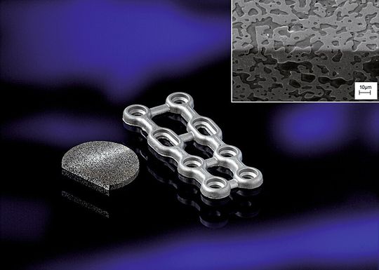 REM-Aufnahme der 90°-Kante mit Durchdringungsstruktur: Die Dimension der Strukturen richtet sich direkt nach der Größe der Pulverpartikel und ist damit genau kontrollierbar. REM-Aufnahme der 90°-Kante mit Durchdringungsstruktur: Die Dimension der Strukturen richtet sich direkt nach der Größe der Pulverpartikel und ist damit genau kontrollierbar.
