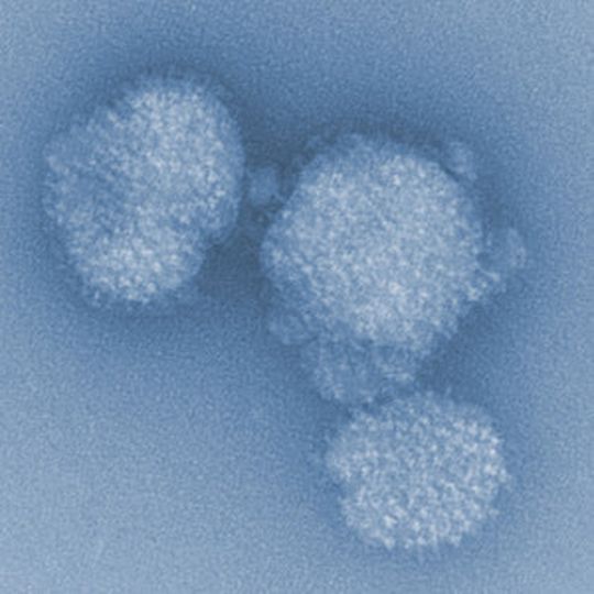 Influenza-Viren in elektronenmikroskopischer Vergrößerung Influenza-Viren in elektronenmikroskopischer Vergrößerung