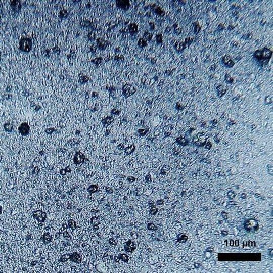 Als Mikroplastik werden allgemein Kunststoffteilchen mit einer Größe von unter fünf Millimetern bezeichnet. Als Mikroplastik werden allgemein Kunststoffteilchen mit einer Größe von unter fünf Millimetern bezeichnet.