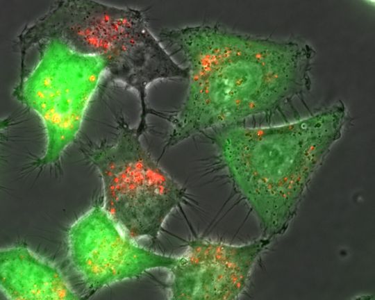 Das K2 Transfection System soll Abwehrmaßnahmen des angeborenen Immunsystems im Rahmen der Transfektion reduzieren. Das K2 Transfection System soll Abwehrmaßnahmen des angeborenen Immunsystems im Rahmen der Transfektion reduzieren.