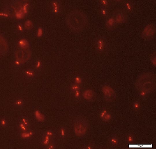 Abb. 1: Mit Nilrot gefärbte Zelle Rhodospirillum rubrum mit dem Fluoreszenzmikroskop beobachtet (Vergrößerung 100x). Abb. 1: Mit Nilrot gefärbte Zelle Rhodospirillum rubrum mit dem Fluoreszenzmikroskop beobachtet (Vergrößerung 100x).