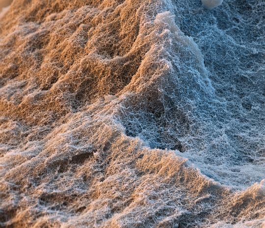 Slentite ist das erste mechanisch stabile Polyurethan-Aerogel für Dämmplatten. Dank seiner Struktur mit Nanoporen zwischen 50 und 100 nm und der damit niedrigeren Wärmeleitfähigkeit, können noch dünnere Dämmplatten hergestellt werden. Dies senkt die Energiekosten und eröffnet gestalterische Freiräume bei der Dämmung. (Vergrößerung 8000:1) Slentite ist das erste mechanisch stabile Polyurethan-Aerogel für Dämmplatten. Dank seiner Struktur mit Nanoporen zwischen 50 und 100 nm und der damit niedrigeren Wärmeleitfähigkeit, können noch dünnere Dämmplatten hergestellt werden. Dies senkt die Energiekosten und eröffnet gestalterische Freiräume bei der Dämmung. (Vergrößerung 8000:1)