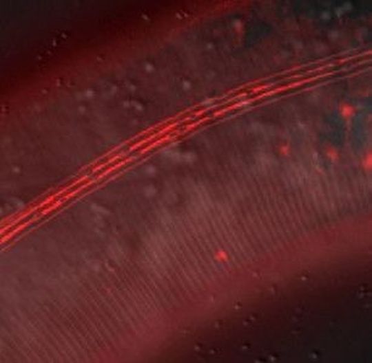 Das Pilzgift dockt an spezifische Zuckerstrukturen auf der Oberfläche des Fadenwurms C. elegans an. Dort, wo sich das Gift anreichert, leuchten die Oberflächenstrukturen hell rot. Das Pilzgift dockt an spezifische Zuckerstrukturen auf der Oberfläche des Fadenwurms C. elegans an. Dort, wo sich das Gift anreichert, leuchten die Oberflächenstrukturen hell rot.