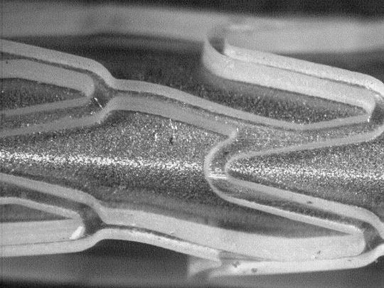 Polymer-Stent: Außendurchmesser 1,8 mm, Wandstärke 0.2 mm. Die Fertigung mit rechtwinkligen und glatten Schnittkanten ist nur mit Ultrakurzpuls-Lasern (UKP) möglich. Polymer-Stent: Außendurchmesser 1,8 mm, Wandstärke 0.2 mm. Die Fertigung mit rechtwinkligen und glatten Schnittkanten ist nur mit Ultrakurzpuls-Lasern (UKP) möglich.