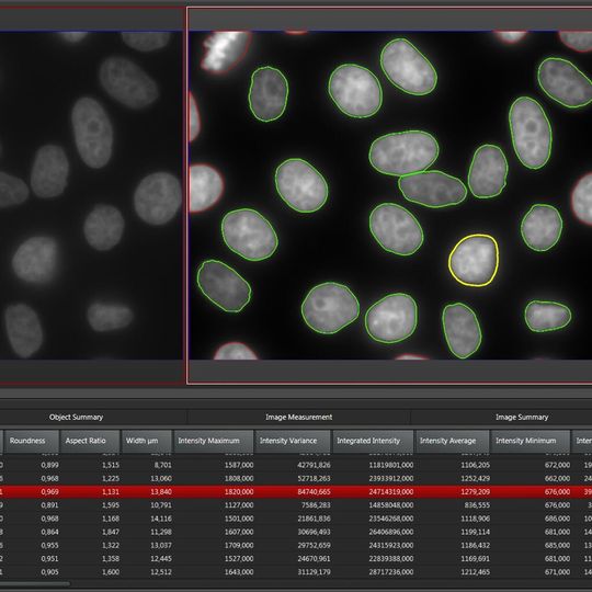 Leica Application Suite Advanced Fluorescence (LAS AF) 4.0 ist die Softwareplattform für anspruchsvolle biomedizinische Forschung mit Weitfeld- und Konfokalmikroskopie. Die Abbildung zeigt das 2D-Analyse Modul bei der automatischen Zellkernzählung. Leica Application Suite Advanced Fluorescence (LAS AF) 4.0 ist die Softwareplattform für anspruchsvolle biomedizinische Forschung mit Weitfeld- und Konfokalmikroskopie. Die Abbildung zeigt das 2D-Analyse Modul bei der automatischen Zellkernzählung.