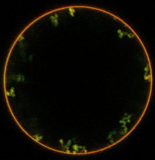 Die Forscher zeigten im Versuch mit synthetischen Vesikeln (rot), dass Neolektin (grün) die Membran dazu bringt, Einstülpungen zu bilden. Auf diesem Weg wäre es möglich, Stoffe mithilfe von Neolektin in Zellen zu transportieren. Die Forscher zeigten im Versuch mit synthetischen Vesikeln (rot), dass Neolektin (grün) die Membran dazu bringt, Einstülpungen zu bilden. Auf diesem Weg wäre es möglich, Stoffe mithilfe von Neolektin in Zellen zu transportieren.