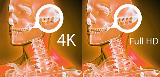 4K- versus Full-HD-Auflösung: Die verbesserte Detailtiefe zeigt sich besonders bei Vergrößerungen von Ausschnitten. 4K- versus Full-HD-Auflösung: Die verbesserte Detailtiefe zeigt sich besonders bei Vergrößerungen von Ausschnitten.