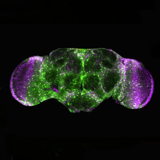 An der Taufliege Drosophila melanogaster können Wissenschaftler sehr gut studieren, wie Neurodegeneration funktioniert bzw. wie Nervenzellen geschädigt werden. An der Taufliege Drosophila melanogaster können Wissenschaftler sehr gut studieren, wie Neurodegeneration funktioniert bzw. wie Nervenzellen geschädigt werden.