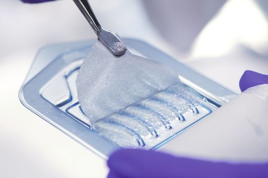 Diese kieselgel-basierte Wundeinlage für diabetische Wunden und Brandwunden ist bereits seit Oktober 2010 als Medizinprodukt zugelassen. Diese kieselgel-basierte Wundeinlage für diabetische Wunden und Brandwunden ist bereits seit Oktober 2010 als Medizinprodukt zugelassen.