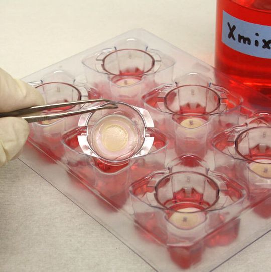 Aus Hautzellen züchten die Wissenschaftler Hautmodelle, an denen neue Anti-Krebswirkstoffe und andere Medikamente getestet werden können. Aus Hautzellen züchten die Wissenschaftler Hautmodelle, an denen neue Anti-Krebswirkstoffe und andere Medikamente getestet werden können.