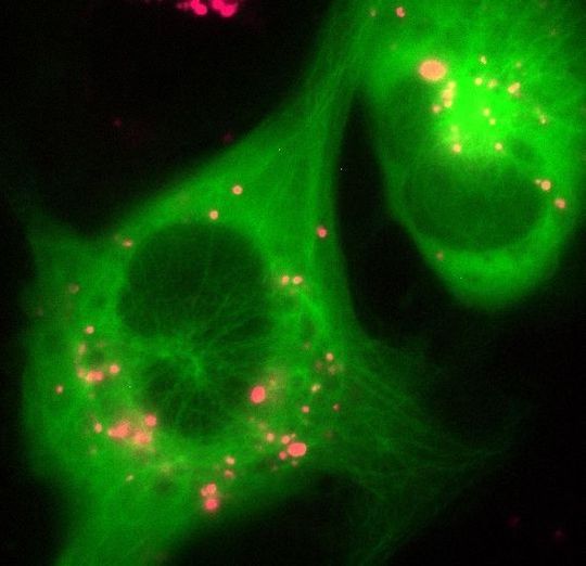 Die Aufnahme zeigt Zellen von Gefäßwänden (grün), die Nanopartikel (magneta) aufgenommen haben. Die Aufnahme zeigt Zellen von Gefäßwänden (grün), die Nanopartikel (magneta) aufgenommen haben.