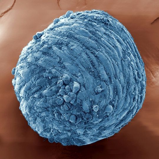 Knochenkugel: Der Sphäroid besteht aus 10 000 menschlichen Knochenzellen. Knochenkugel: Der Sphäroid besteht aus 10 000 menschlichen Knochenzellen.