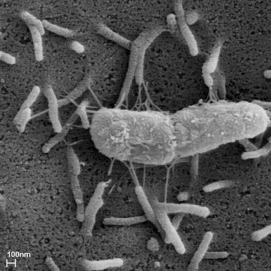 Enterobacteriaceen mit Resistenz gegen bestimmte Antibiotika sind zunehmend ein Problem bei Krankenhaus-Infektionen. Enterobacteriaceen mit Resistenz gegen bestimmte Antibiotika sind zunehmend ein Problem bei Krankenhaus-Infektionen.