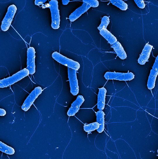 Rasterelektronenmikroskopische Aufnahme von Zellen des E. coli Typstamms DSM 30083T Rasterelektronenmikroskopische Aufnahme von Zellen des E. coli Typstamms DSM 30083T